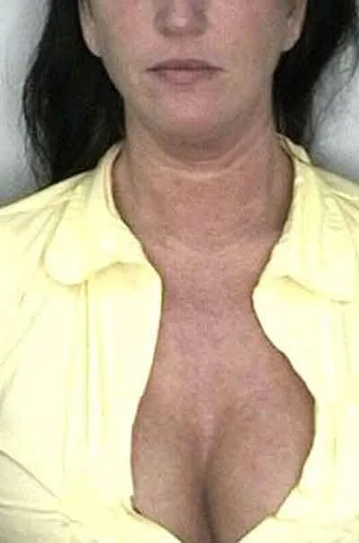 Merete Blakstad